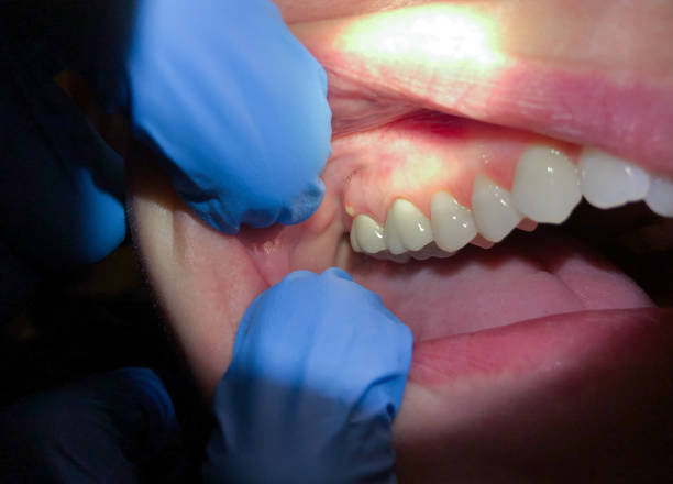 Best Same-Day Dentist Appointment  in Quinnipiac University, CT