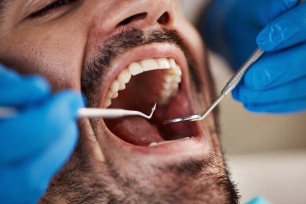 Best Knocked-Out Tooth Emergency  in Quinnipiac University, CT